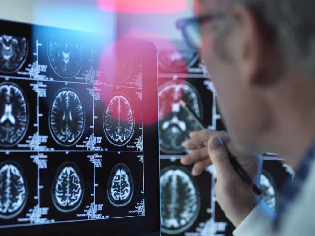 A doctor views brain scans for the early detection of neurodegenerative disease.